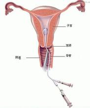 ���в���